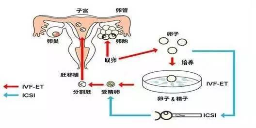 南京试管婴儿技术